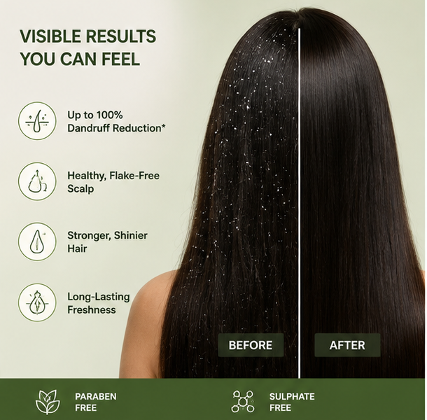 Bare Anatomy Anti-Dandruff Shampoo | Up To 100% Dandruff Reduction | ZPTO-Free | pH 5.3 | Salicylic Acid, Piroctone Olamine, Biotin & Menthol | Non-Drying Formula | Suitable for Men & Women | 250 ml